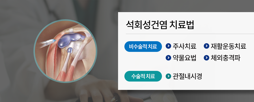 석회성건염 치료법