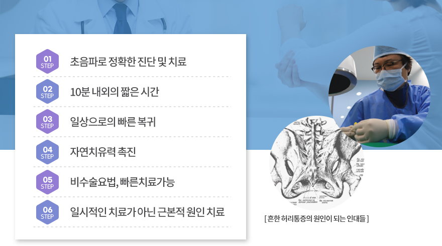 프롤로테라피 장점